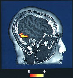 https://upload.wikimedia.org/wikipedia/commons/thumb/e/ef/Fusiform_face_area_face_recognition.jpg/250px-Fusiform_face_area_face_recognition.jpg