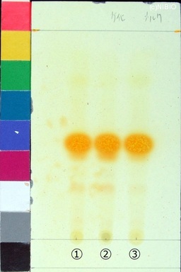 http://mpdb.nibiohn.go.jp/CONTENTS_ROOT/JP_IDENTIFICATION_PHOTO_DATA/JP_IDENTIFICATION_PHOTO_FILE/thumbnail/95.jpg