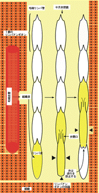 https://upload.wikimedia.org/wikipedia/commons/thumb/0/0c/Lymph_vessel-ja.png/200px-Lymph_vessel-ja.png