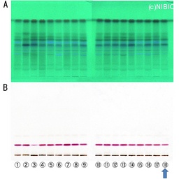 http://mpdb.nibiohn.go.jp/CONTENTS_ROOT/TLC_DATA/TLC_FIG_FILE/thumbnail/648.jpg