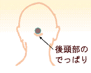 width=