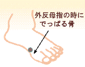 width=