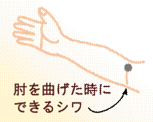 width=