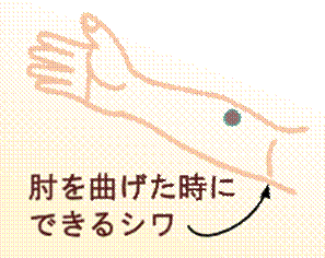 width=