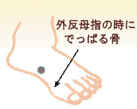width=