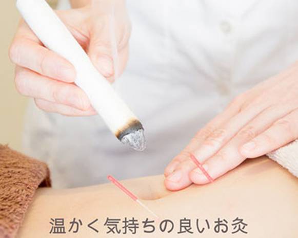膀胱炎にお灸の効果