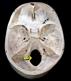 Crane4 Foramen magnum.png