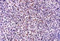 http://mpdb.nibiohn.go.jp/CONTENTS_ROOT/PLANT_PHOTO_DATA/PHOTO_FILE/thumbnail/987.jpg