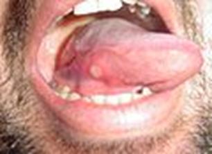 https://upload.wikimedia.org/wikipedia/commons/thumb/1/13/Afta_foto.jpg/120px-Afta_foto.jpg