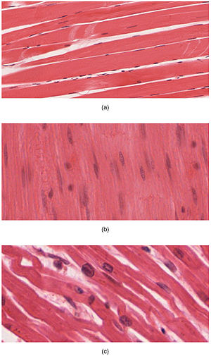 https://upload.wikimedia.org/wikipedia/commons/thumb/e/e5/414_Skeletal_Smooth_Cardiac.jpg/300px-414_Skeletal_Smooth_Cardiac.jpg