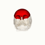 https://upload.wikimedia.org/wikipedia/commons/thumb/f/f2/Rotation_frontal_bone.gif/150px-Rotation_frontal_bone.gif